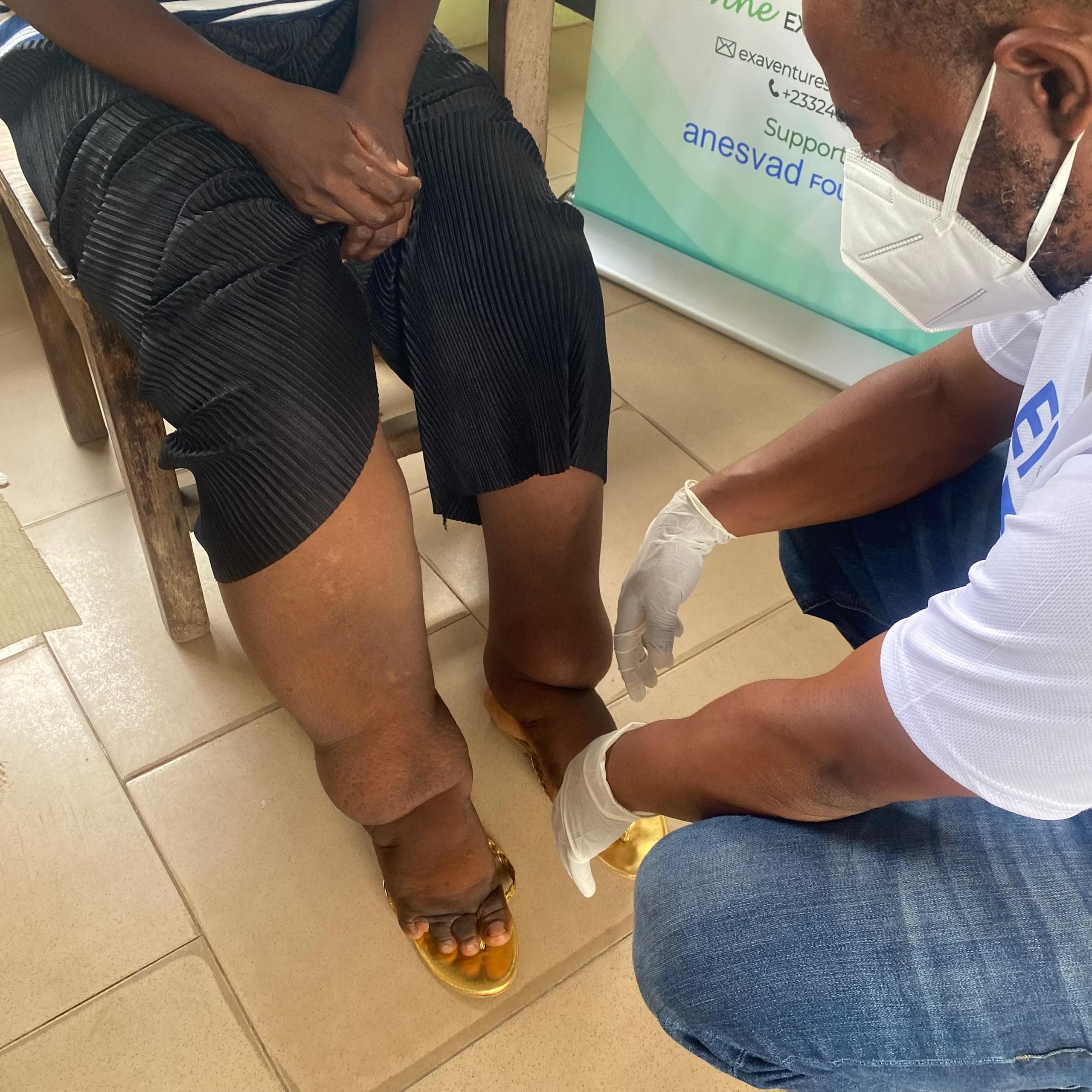 EXA-ANESVAD field activity — NTD care